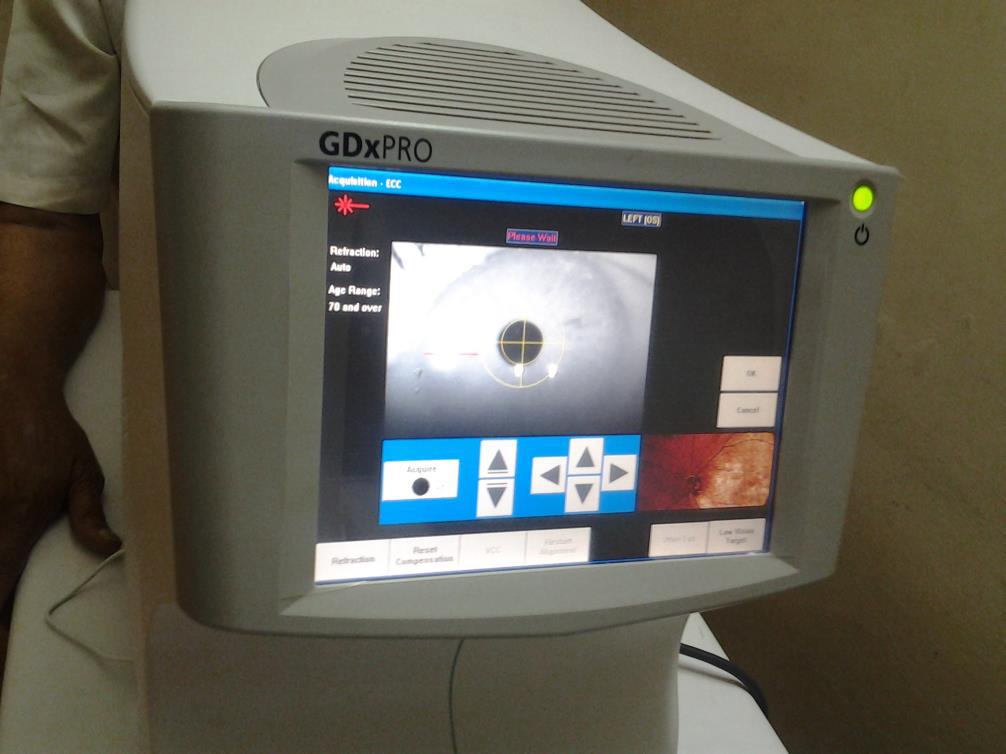 Glaucoma 7
